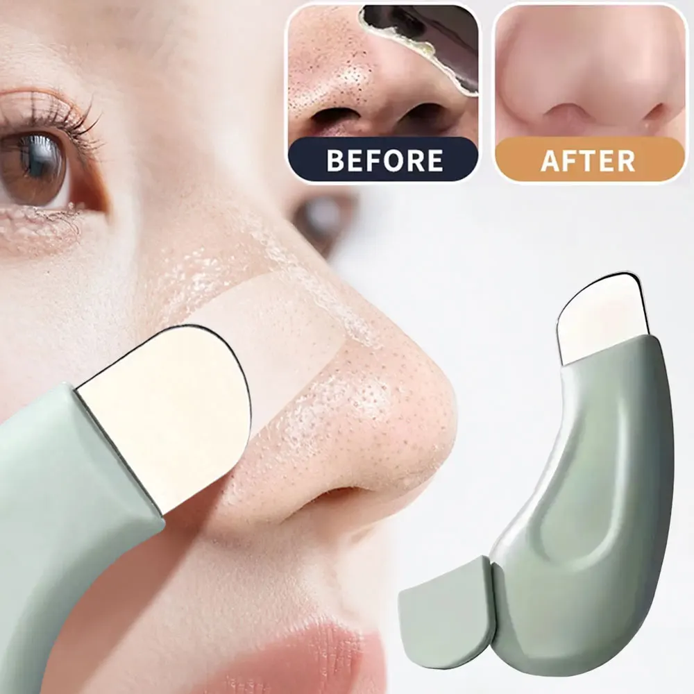 Nasal Aspirator - Deep Cleansing Blackhead & Whitehead Removal