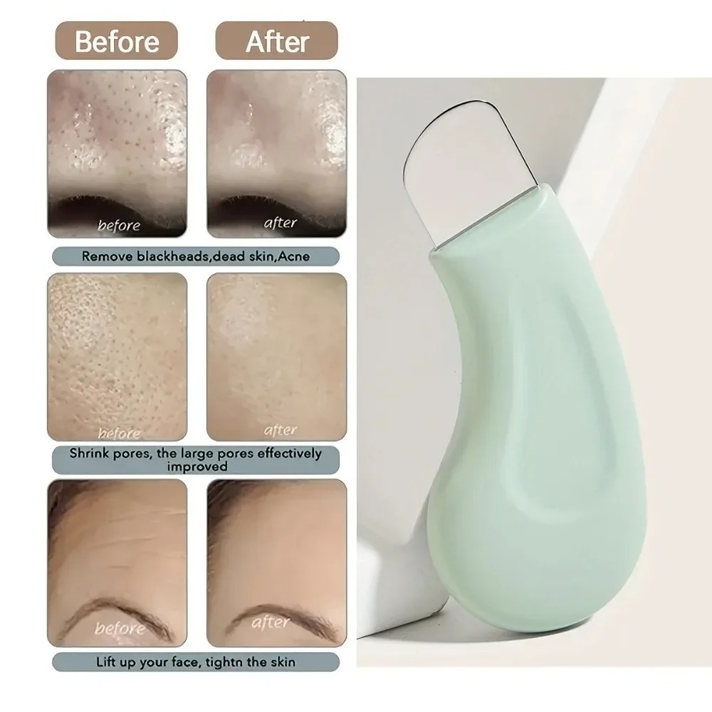 Deep Cleansing Blackhead White - đánh giá và giá Nasal Aspirator