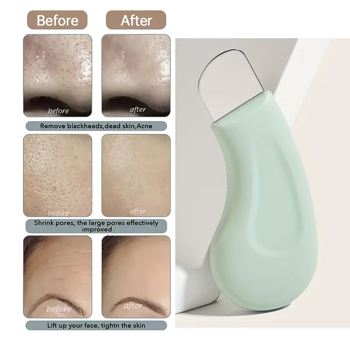 1Pcs Blackhead and Whitehead R - đánh giá và giá Nasal Aspirator